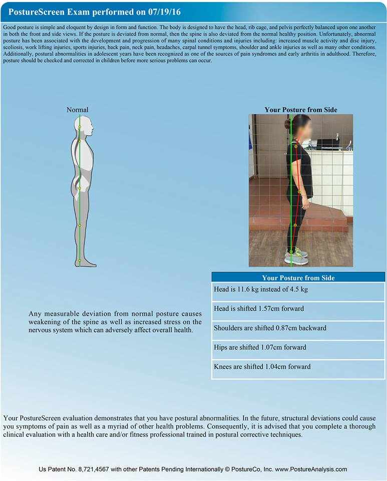 postural assessment