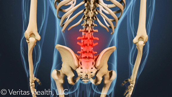 low-back-pain-symptoms